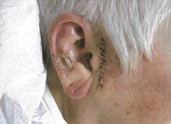 Before and after photo